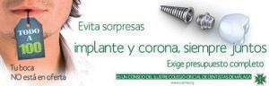 Colegio de Dentistas de Málaga - El Colegio aconseja sobre el precio de los implantes