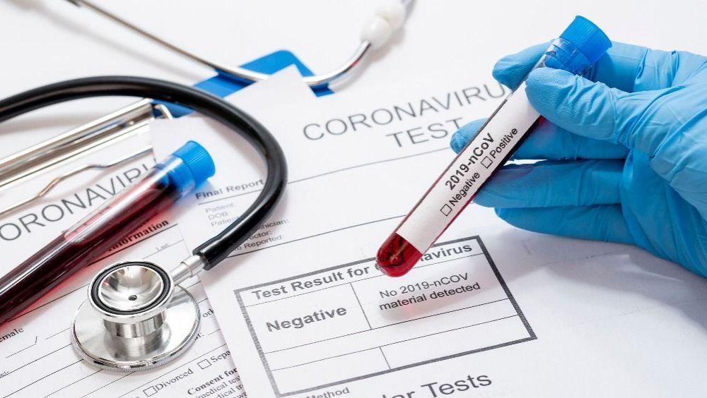 Comunicado del Consejo General de Dentistas sobre prescripción de pruebas diagnósticas COVID-19