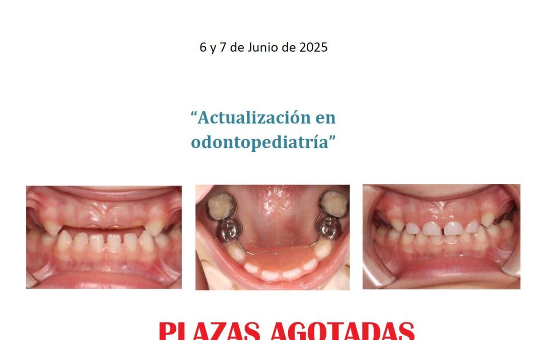 Agotadas las plazas del curso: «Actualización en Odontopediatría»