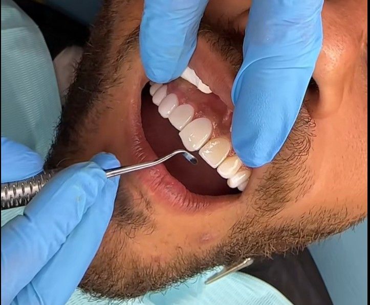 El Consejo General de Dentistas alerta sobre el turismo dental en Marruecos